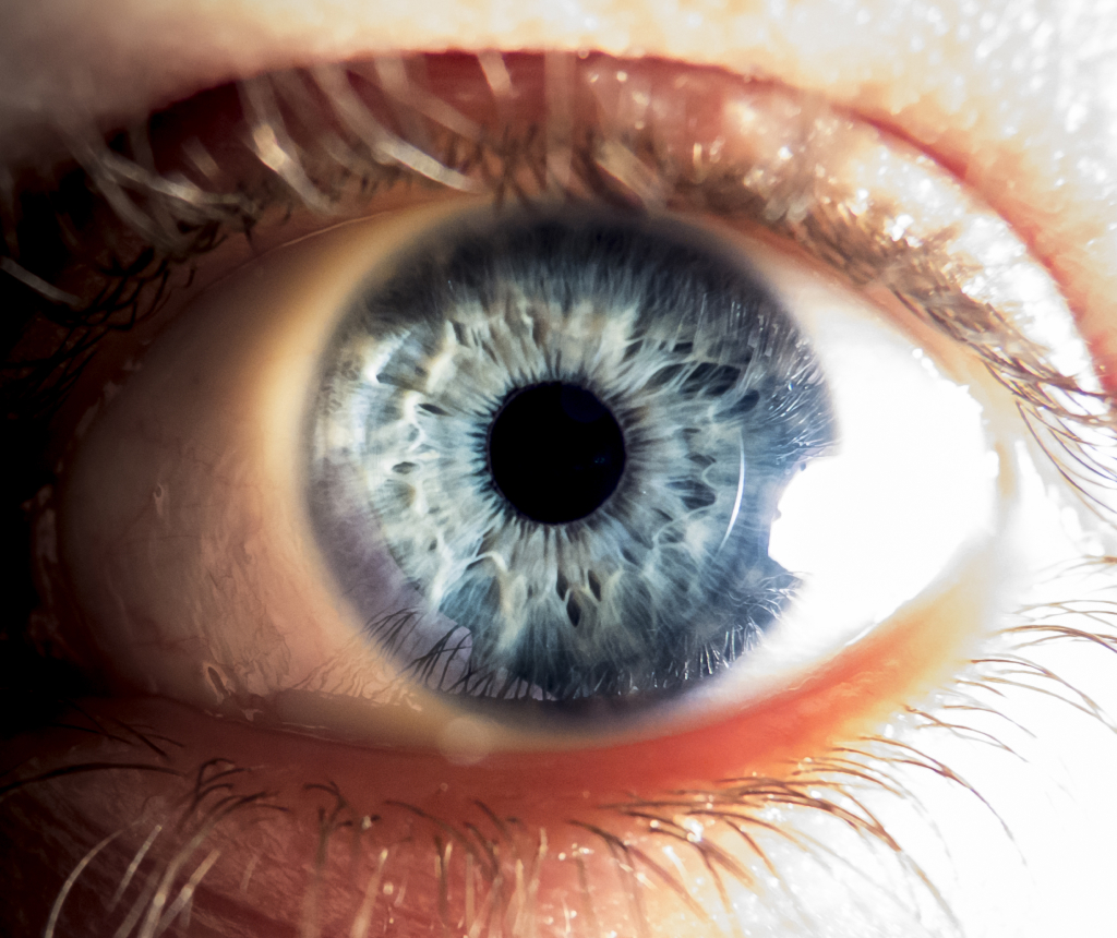 Eye Health Image